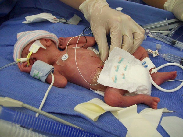 baby born 3 months early