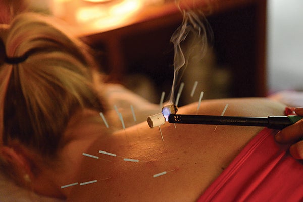 Herbs like moxa can be placed on the ends of the needles during acupuncture.